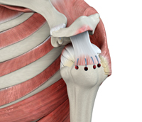 Rotator Cuff Repair Rehabilitation Protocol